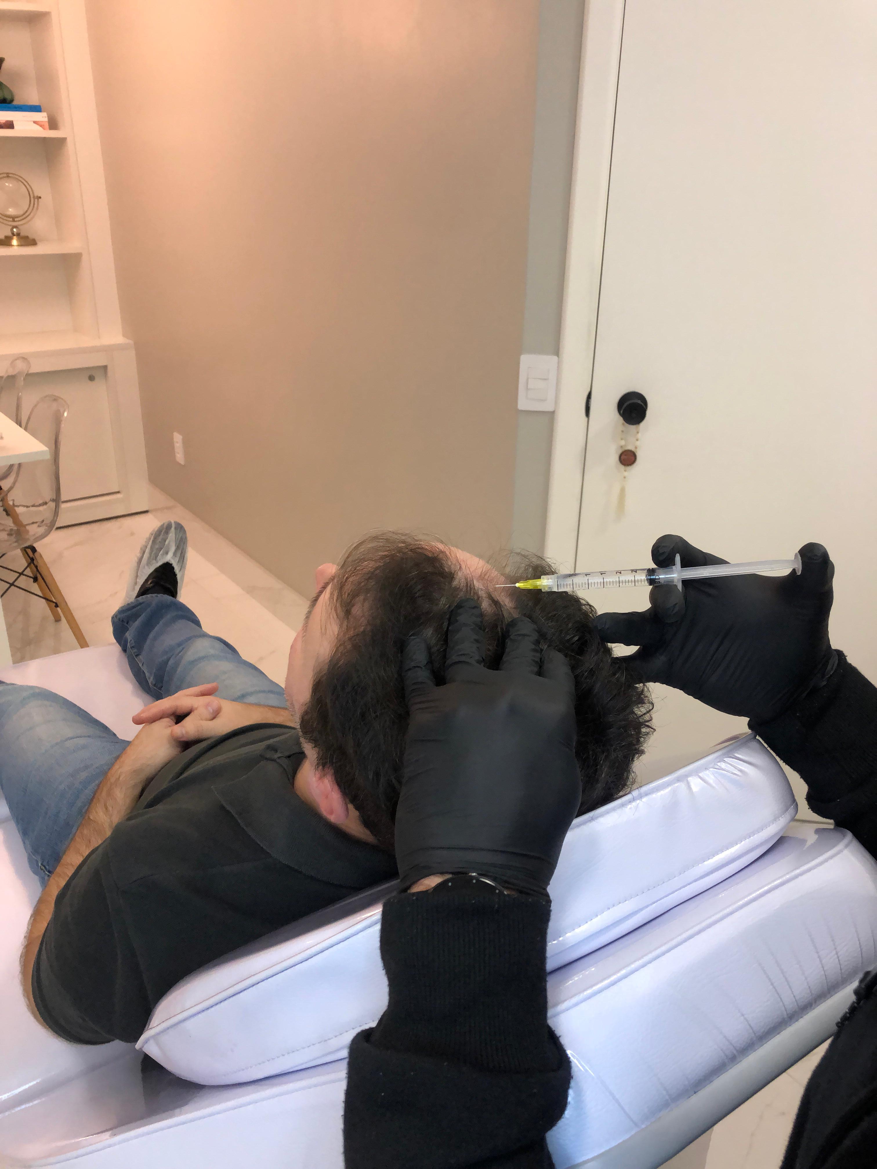 tratamentos capilares