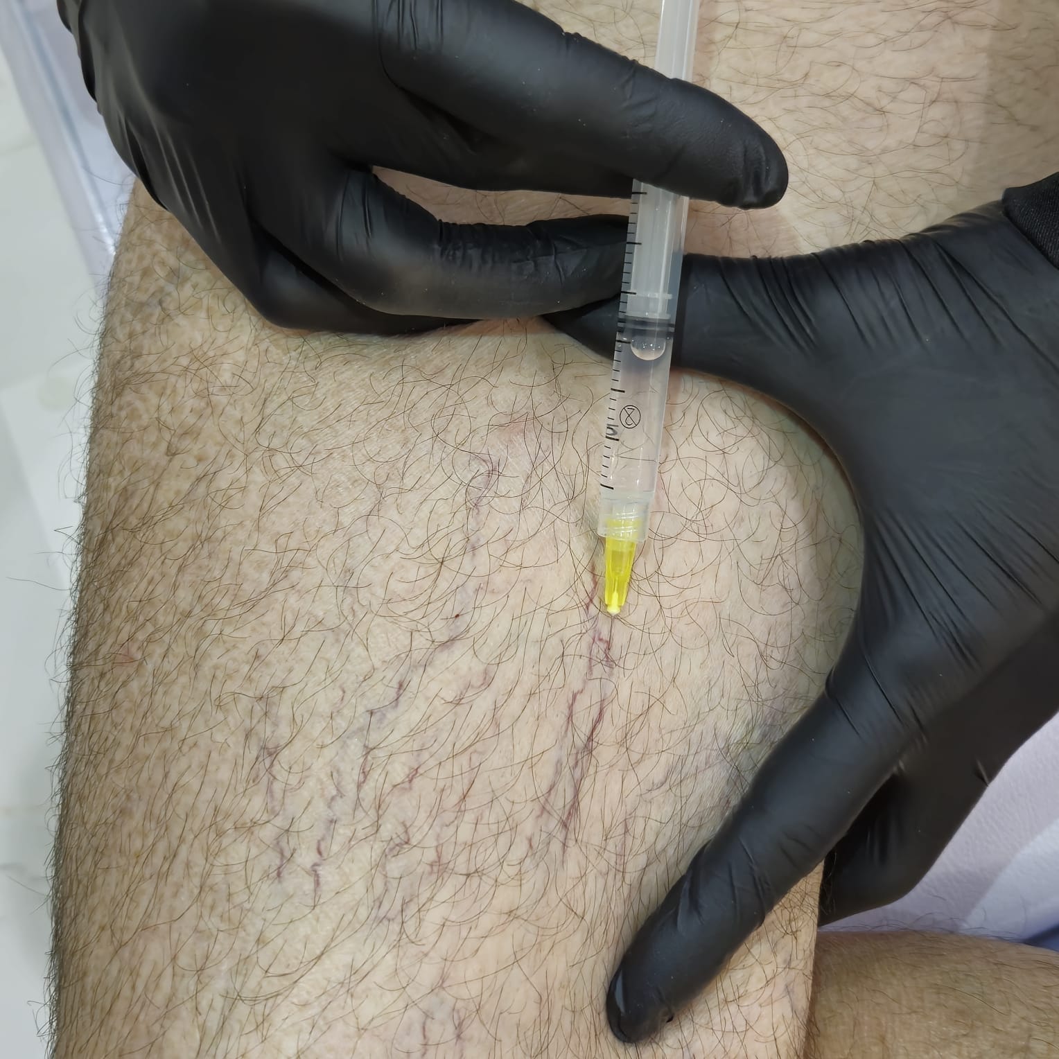 PEIM (SECAGEM DE VASINHOS)